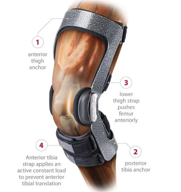 DonJoy 11-1443-2 Armor FP - ACL, STD, LT, S